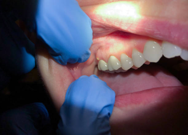 Best Broken or Cracked Tooth Emergency Dentist in Union Point, GA
