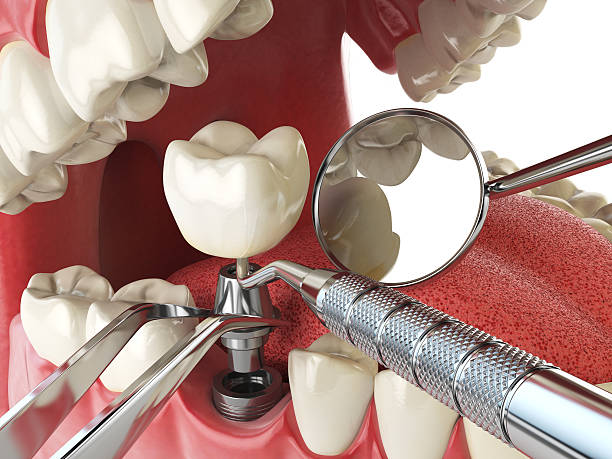 Best Urgent Dental Care for Toothache in Union Point, GA
