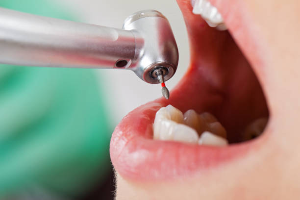 Best Emergency Dental Services for Seniors in Union Point, GA